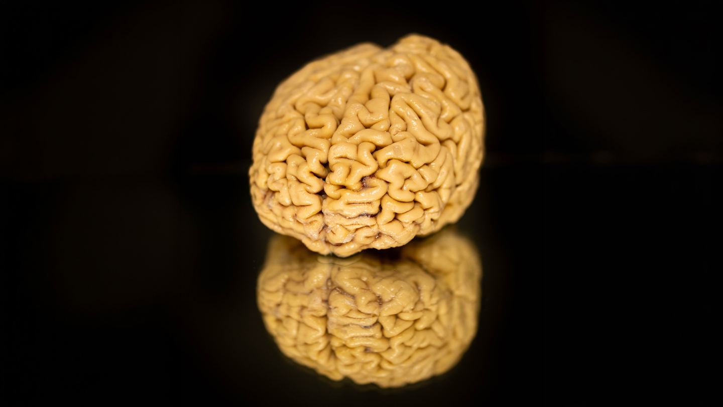 The remarkable brains of ‘SuperAgers’ hold clues about how we age